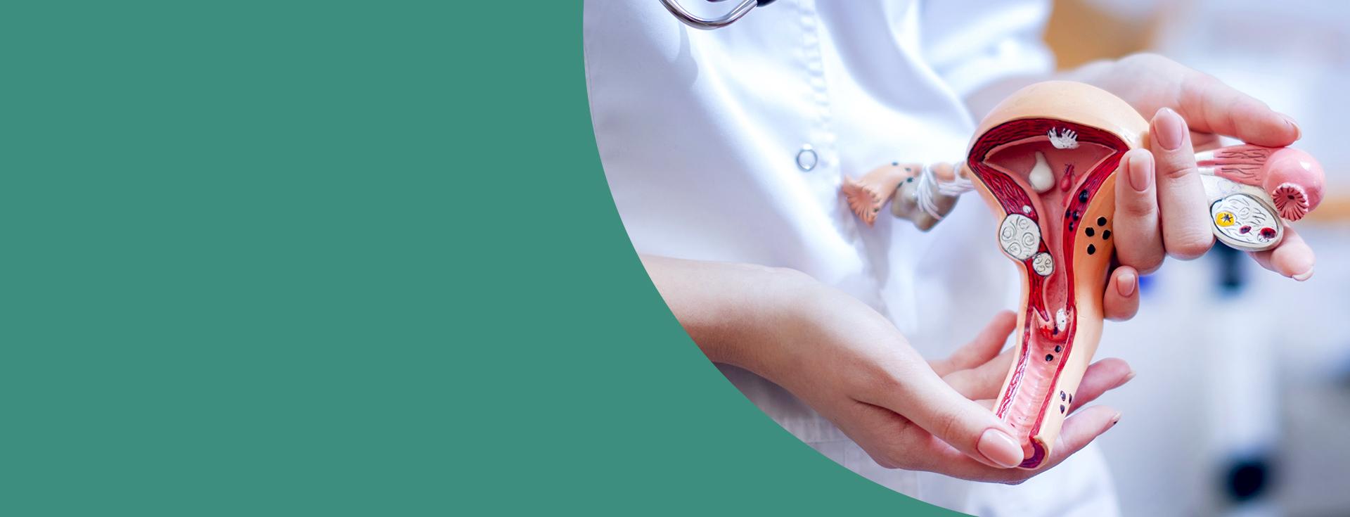 Mãos brancas de uma médica segurando um útero feito para aulas de medicina